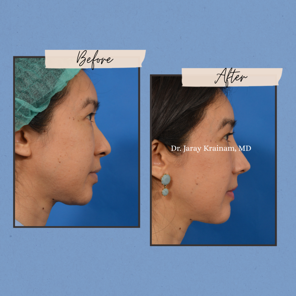 calling cards 10 - Dr. Jaray Cosmetic Surgery