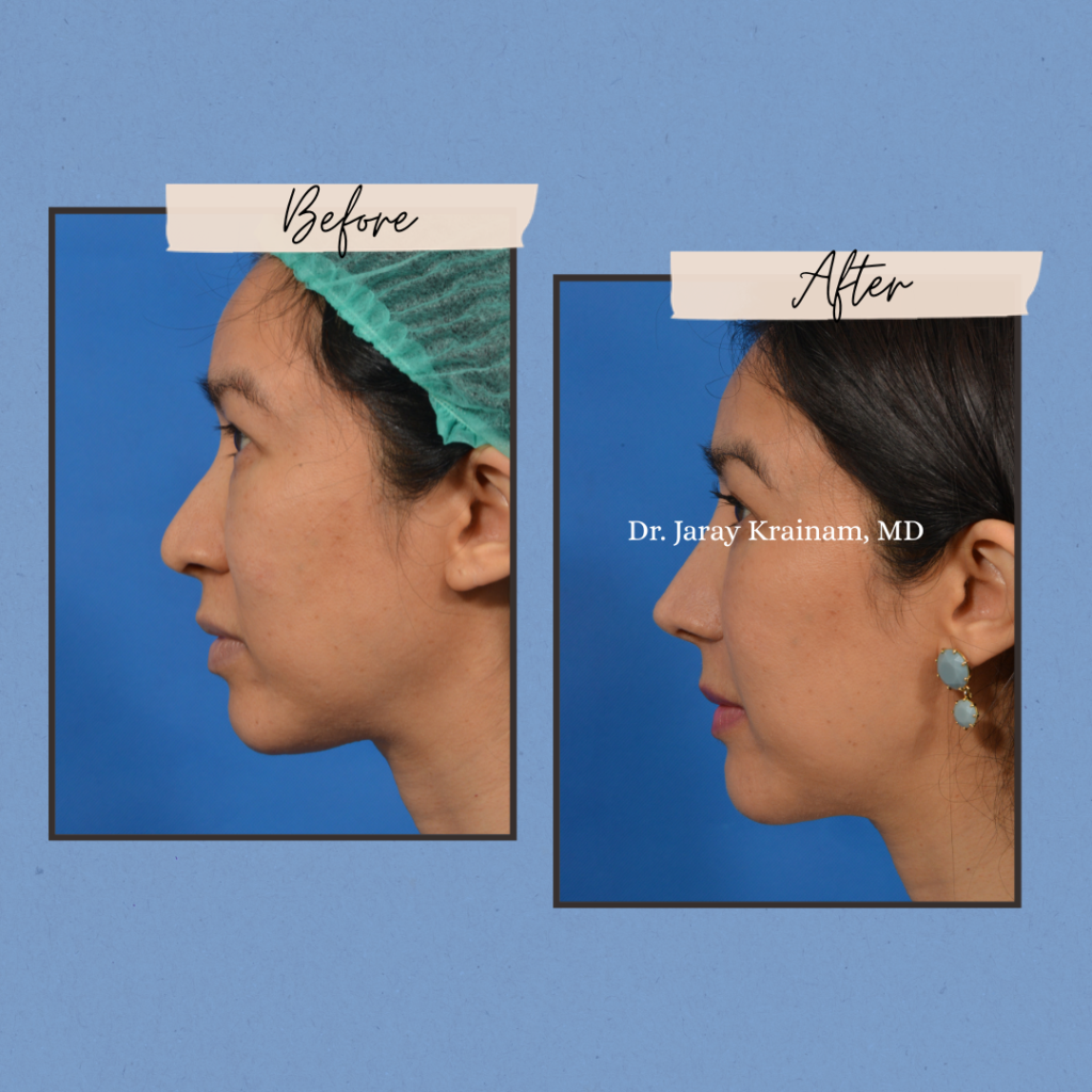 calling cards 11 - Dr. Jaray Cosmetic Surgery