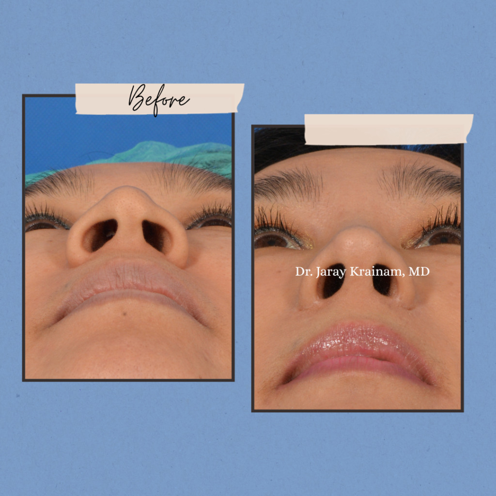 calling cards 12 - Dr. Jaray Cosmetic Surgery