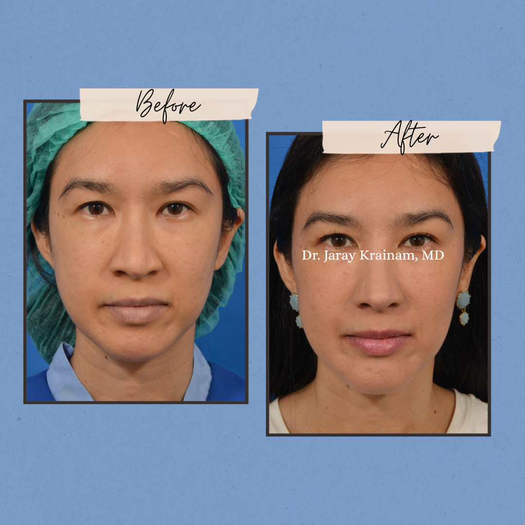 calling cards 6 - Dr. Jaray Cosmetic Surgery