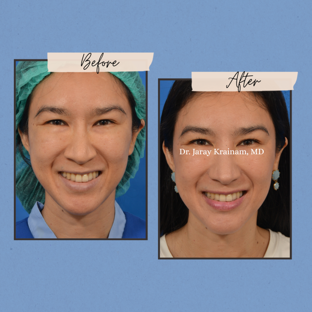 calling cards 7 - Dr. Jaray Cosmetic Surgery