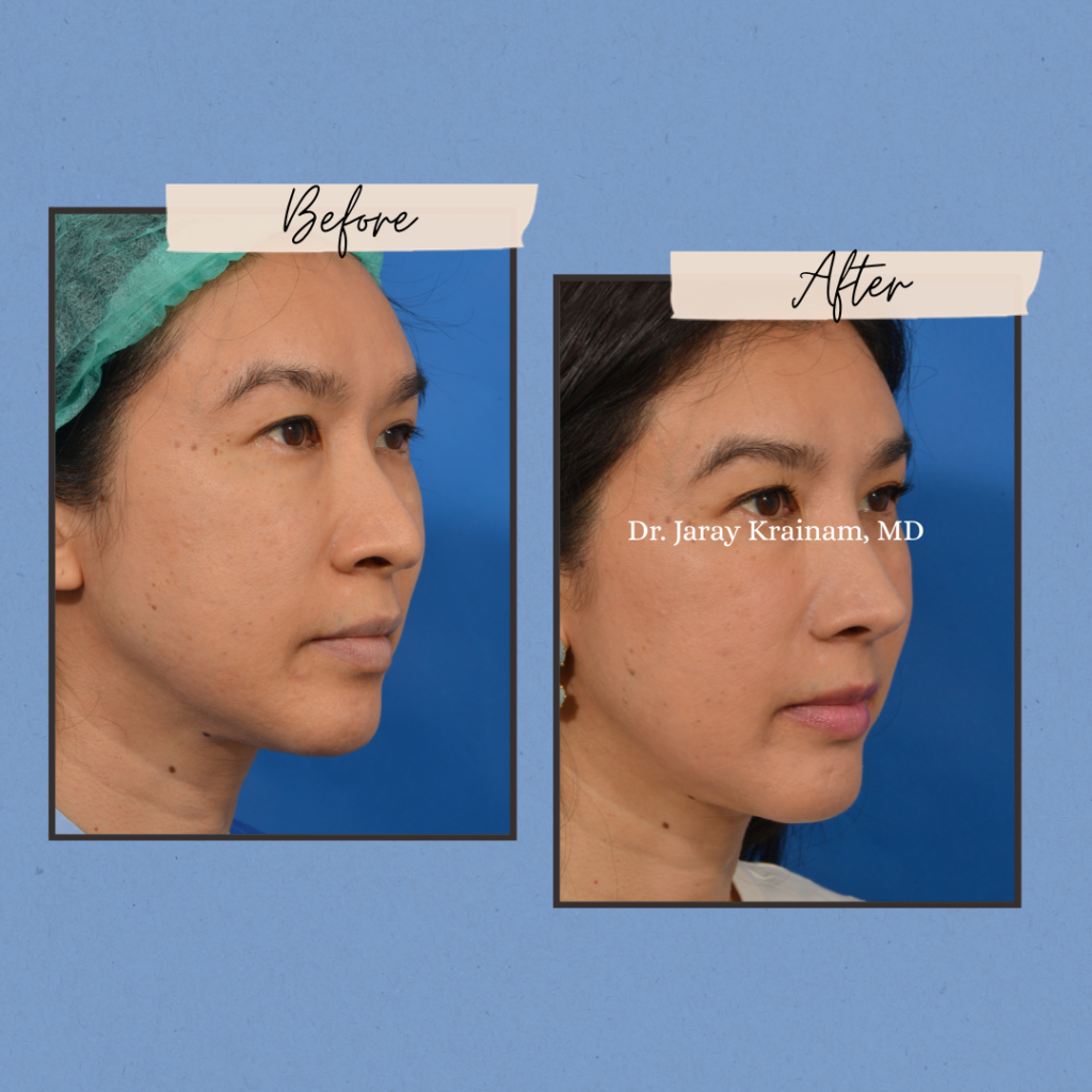 calling cards 8 - Dr. Jaray Cosmetic Surgery