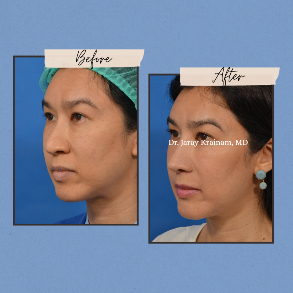 calling cards 9 - Dr. Jaray Cosmetic Surgery