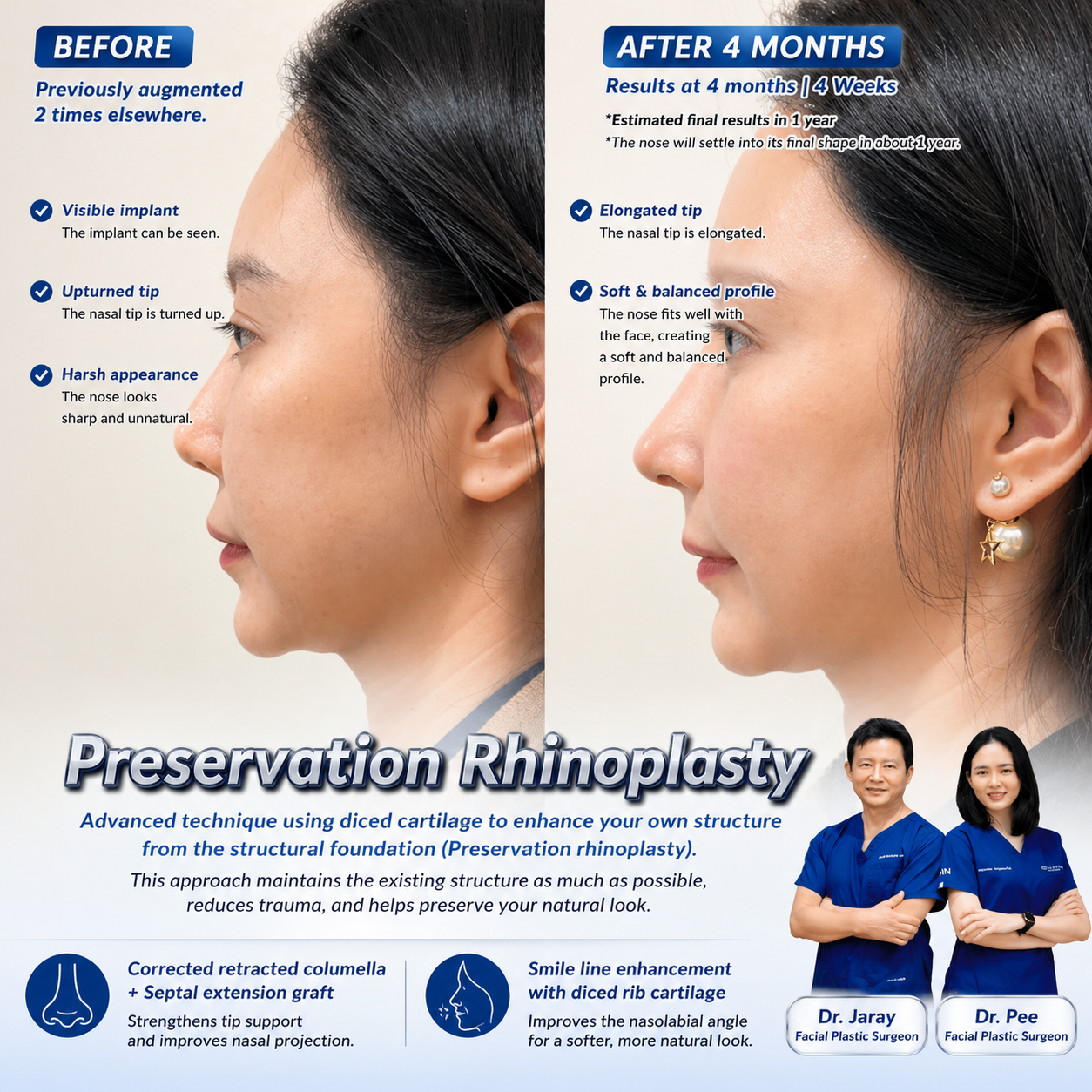 ChatGPT Image Apr 28 2026 01_19_52 PM - Dr. Jaray Cosmetic Surgery
