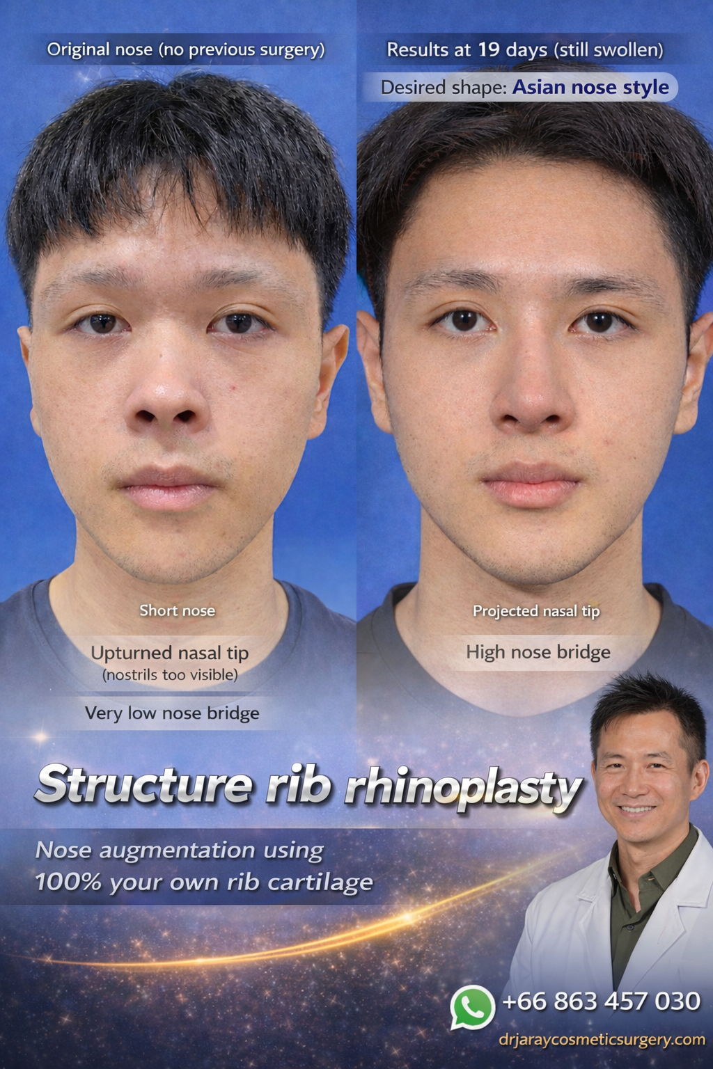ChatGPT Image Apr 3 2026 11_14_09 AM - Dr. Jaray Cosmetic Surgery