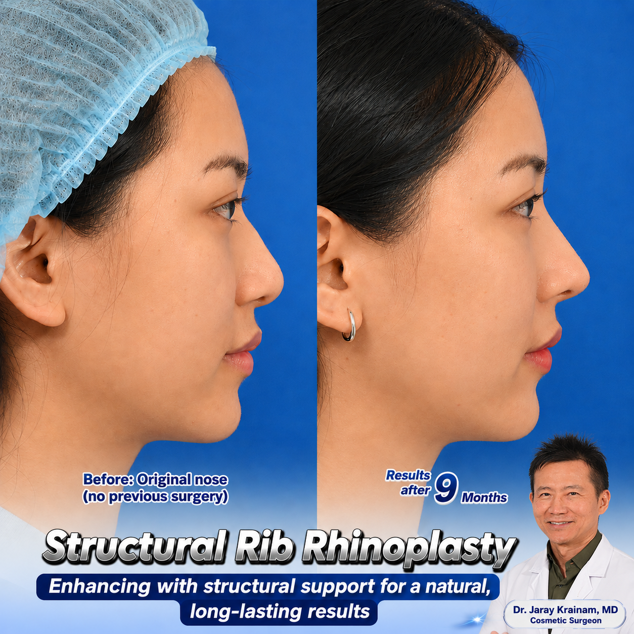 ChatGPT Image May 13 2026 12_06_37 PM - Dr. Jaray Cosmetic Surgery